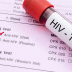Al via i test rapidi e gratuiti dell’HIV nei territori di Caserta, Castel Volturno e Avellino